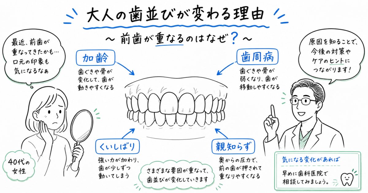 大人になって歯並びが変わる原因は？加齢や歯周病との関係と対処法