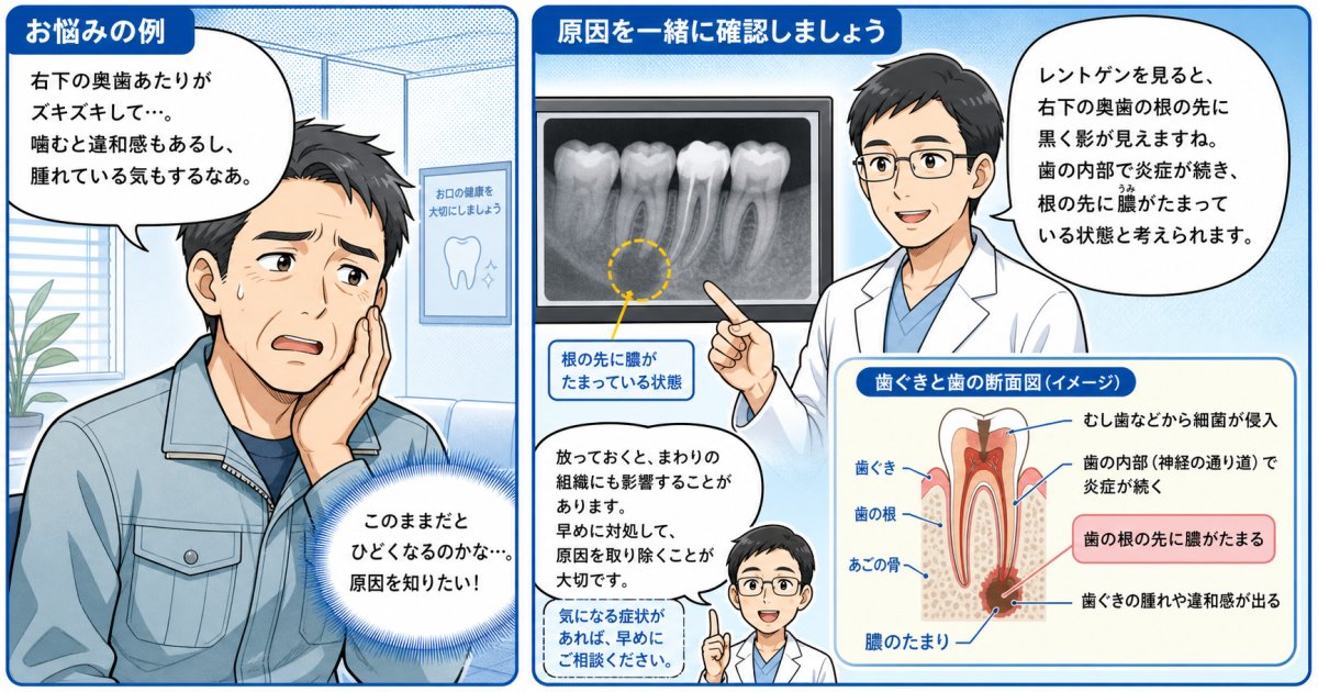 歯茎の腫れと膿を繰り返す原因は？痛みが引いても放置が危険な理由