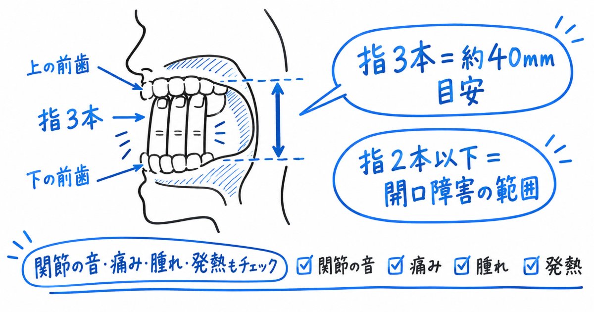 指の本数で確かめる口の開き具合の目安