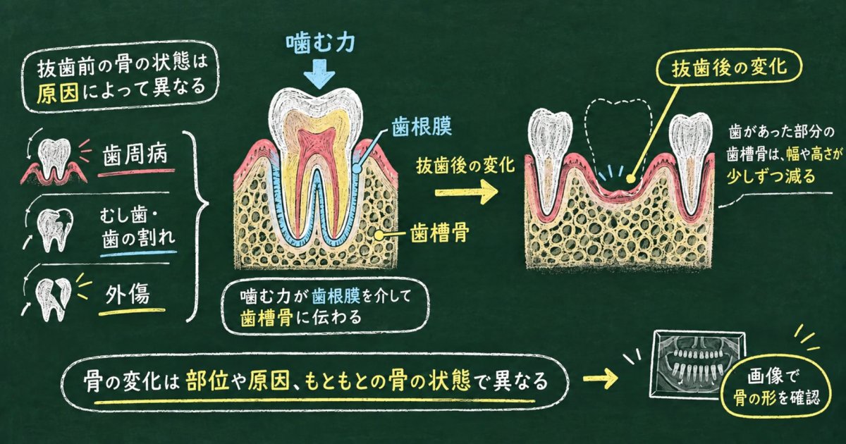 歯を失うと顎の骨が「溶ける」と言われるのはなぜ?